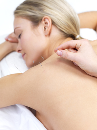 acupuntura
